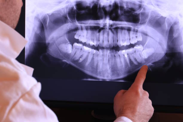Best Emergency Treatment for Toothache in Denison, TX