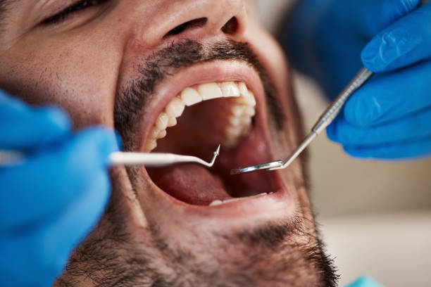 Best Walk-In Emergency Dentist in Denison, TX