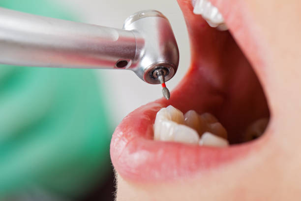 Best Pediatric Emergency Dentist in Denison, TX